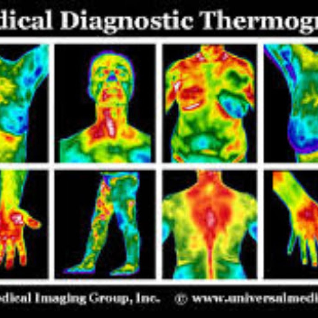 Thermography Boca Raton