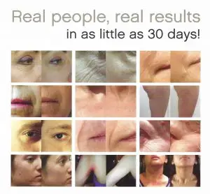 before and after images of people who've taken skinade