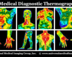 Medical Thermography Screening Available by Appointment Every Thursday at BeautySmart in Boca Raton